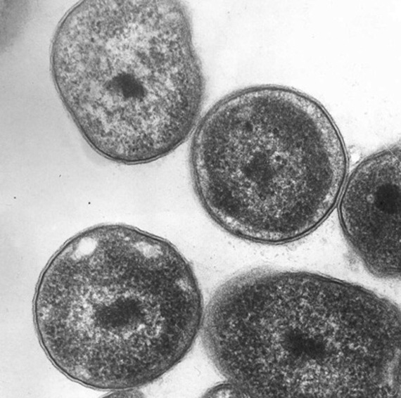 La Methylocella silvestris puede desarrollarse tanto en el metano y en el propano se encuentra en el gas natural. Foto: Joint Genome Institute