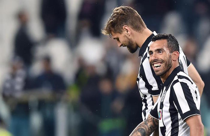 Sorprende la cantidad de futbolistas que descuidan lo que pasa en sus dientes. Foto: EFE