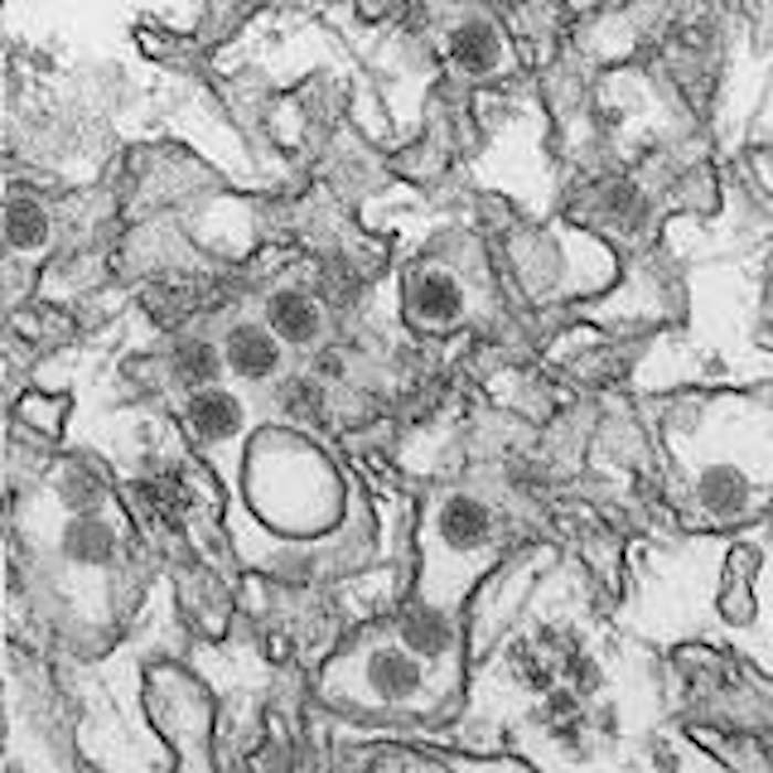 Esta Imagen De Enero De Proporcionada Por Los Centros Para El Control Y La Prevención De Enfermedades cdc Muestra El Virus Zika Foto Ap