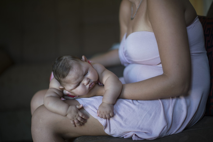 Gleyse Kelly Da Silva Sostiene a Su Bebé María Giovanna En Su Casa De Recife Brasil El De Enero Del La Niña Padece De Microcefalia Las Autoridades Brasileñas Dicen Que Hay Un Gran Aumento En La Cantidad De Casos De Microcefalia En El País Y Que Creen Que Puede Responder Al Virus Del Zika Que Irrumpió En Brasil El Año Pasado Foto Ap