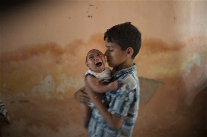 Niño Que Sufrió Daño Cerebral a Causa Del Virus Del Zika Foto Efe