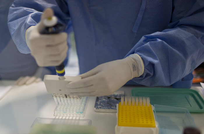 Un Estudiante De Posgrado Analiza Muestras Para Detectar El Virus De Zika En Un Laboratorio En El Instituto Fiocruz En Río De Janeiro Brasil El Viernes De Enero De Autoridades De Salud Dicen Que Intentan Determinar Si Un Incremento Inusual En El Número De Casos De Una Rara Afección Nerviosa que En Ocasiones Es Lo Suficientemente Severa Para Causar Parálisis Está Relacionado Con La Propagación Del Virus Zika Al Menos En Dos Países Latinoamericanos El Virus Es Transmitido Mediante Picadura De Un Mosquito Foto Leo Correa Ap