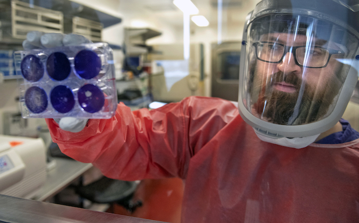 Matt Dunn, investigador del Centro de Investigación de Vacunas de la Universidad de Pittsburgh, manipula muestras del coronavirus, que causa la enfermedad COVID-19, el 27 de febrero de 2020, en Oakland, Pennsylvania. Foto: Nate Guidry/Pittsburgh Post-Gazette vía AP