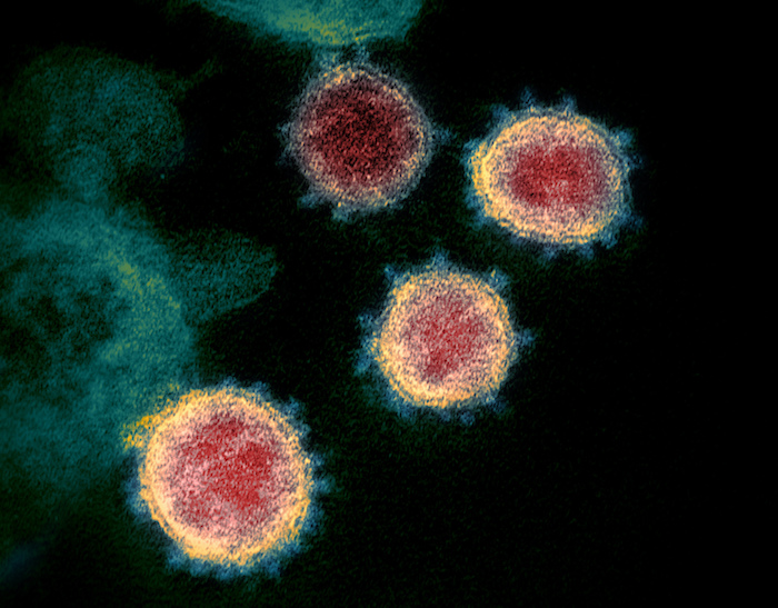 En esta imagen de archivo, tomada a través de un microscopio y sin fecha, distribuida por los Institutos Nacionales de Salud de Estados Unidos en febrero de 2020, se muestra el coronavirus que causa el COVID-19. Foto: NIAID-RML vía AP