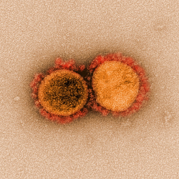 Los coronavirus, incluido el más nuevo, cuentan con brazos delgados que cubren su superficie como una corona.