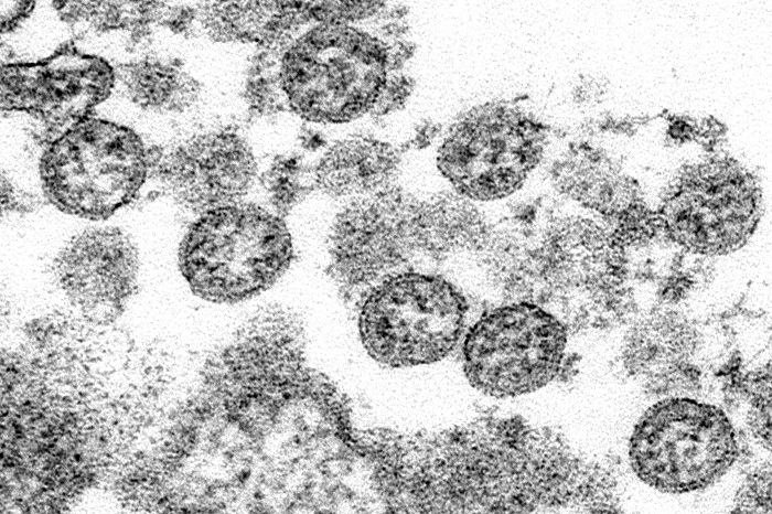 Esta Imagen De Microscopio Cortesía De Los Centros Para El Control Y Prevención De Enfermedades De Estados Unidos Muestra Partículas Esféricas De Coronavirus Del Primer Caso De Covid En Estados Unidos