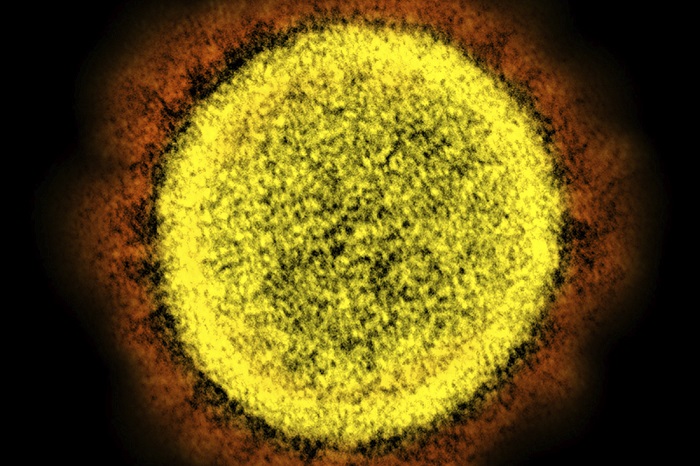 Esta Imagen De Microscopio Electrónico Dada a Conocer Por El Instituto Nacional De Alergia Y Enfermedades Infecciosas Muestra Una Partícula Del Nuevo Coronavirus Sars cov Aislada De Un Paciente En Un Laboratorio En Fort Detrick Maryland