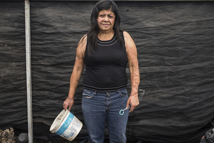 Elisa Xolalpa, quien sobrevivió a un ataque con ácido por su expareja hace 20 años cuando ella tenía 18 años, posa para un retrato en su invernadero en Ciudad de México, el sábado 12 de junio de 2021. Supervivientes como Xolalpa quiere que este tipo de ataques sean clasificados como atento de feminicidio, además de que reciban apoyo con las innumerables cirugías y terapias psicológicas.