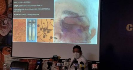 Fernando Muñoz Estrada, jefe del Servicio Dermatológico del Hospital Civil de Culiacán, informa sobre el hongo negro.