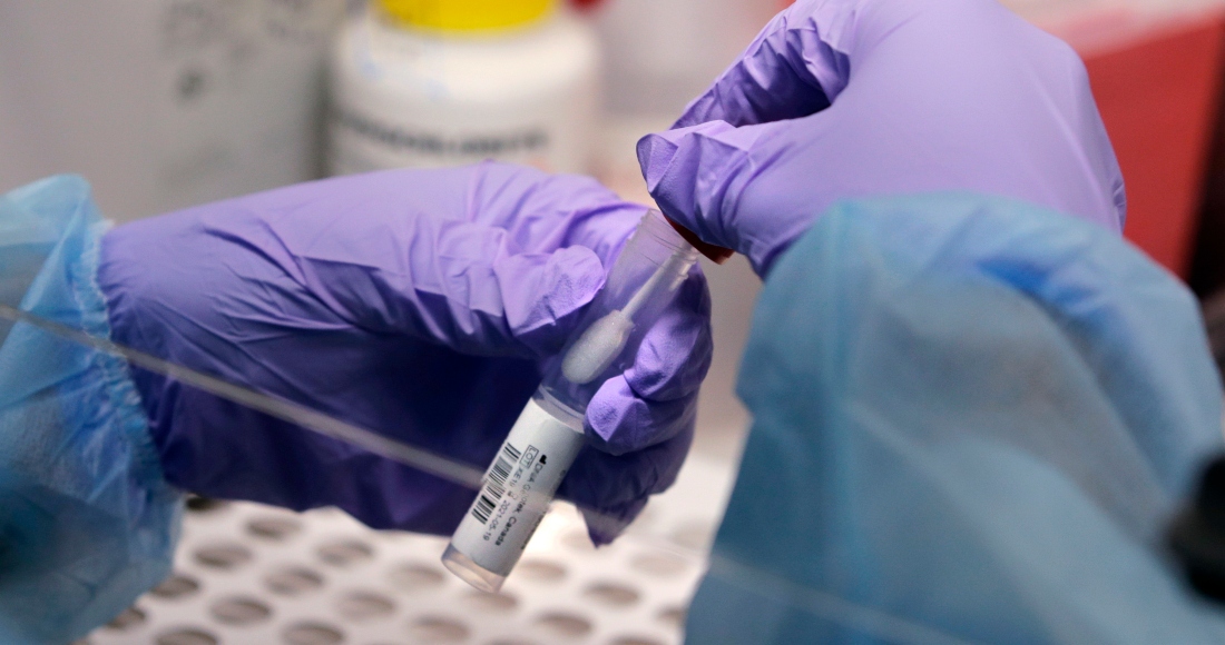 James Robson, estudiante de ingeniería biomédica sostiene una muestra de una nueva variante del coronavirus en un laboratorio de la Universidad de Boston en Boston, 23 de julio de 2020.