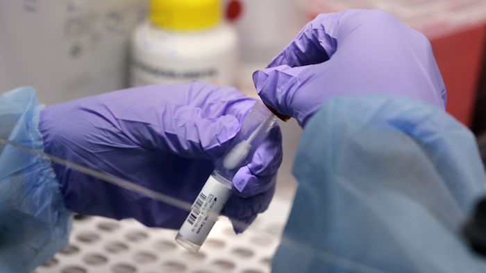 James Robson, estudiante de ingeniería biomédica sostiene una muestra de una nueva variante del coronavirus en un laboratorio de la Universidad de Boston en Boston, 23 de julio de 2020.