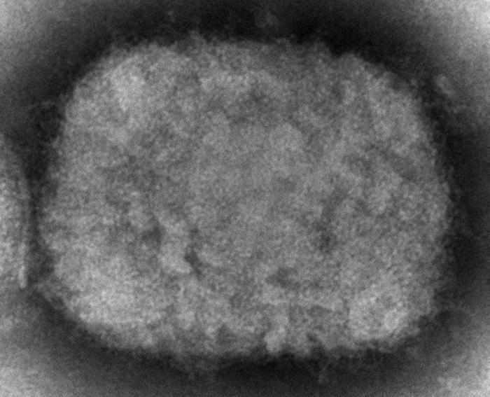 Esta Imagen De Microscopio De Proporcionada Por Los Centros Para El Control Y La Prevención De Enfermedades De Estados Unidos cdc Por Sus Siglas En Inglés Muestra Un Virión Del Virus De La Viruela Símica Obtenido De Una Muestra Relacionada Con Un Brote En Perros