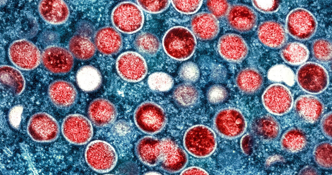 Esta imagen proporcionada por el Instituto Nacional de Alergias y Enfermedades Infecciosas de EU (NIAID) muestra una micrografía electrónica de partículas de viruela del simio (rojas) encontradas dentro de una célula infectada (azules) cultivadas en laboratorio.