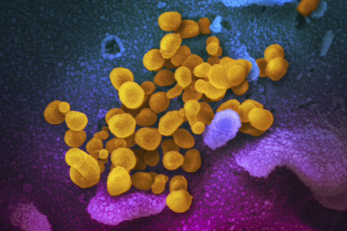 Esta imagen de microscopio electrónico distribuida por los Institutos Nacionales de Salud de EU en febrero de 2020 muestra el coronavirus SARS-CoV-2, indicado en amarillo, emergiendo de la superficie de las células (azul/rosa).