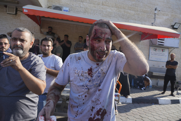 Un palestino herido en ataques aéreos israelíes llega al hospital de Al Aqsa en la ciudad de Der el-Balah, en la Franja de Gaza, el sábado 14 de octubre de 2023.