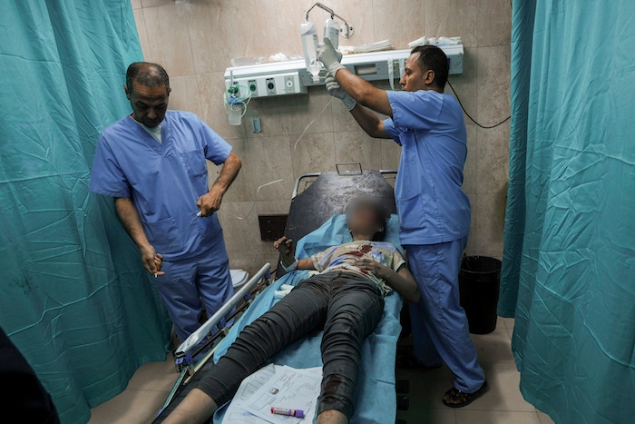 Una niña palestina herida durante un ataque aéreo israelí recibe atención médica en el hospital de Al-Aqsa en Deir el-Balah, en el centro de la Franja de Gaza, el domingo 15 de octubre de 2023.