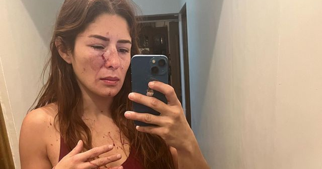 La deportista mexicana, Daniela López Mejía, denunció a través de sus redes sociales que fue víctima de violencia por parte de su expareja.