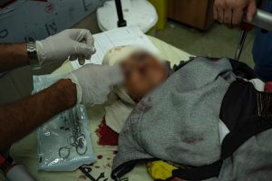 Un niño palestino herido en los bombardeos israelíes sobre la Franja de Gaza es atendido en un hospital en Jan Yunis, el 15 de noviembre de 2023.