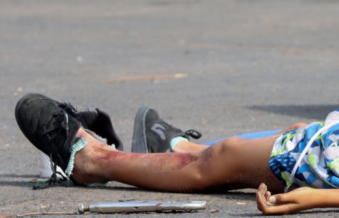 Uno de los menores atropellados resultó con heridas graves y se reporta como delicado. Imagen de referencia. Foto: Rogelio Morales, Cuartoscuro