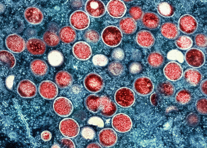 En esta imagen sin fecha, proporcionada por el Instituto Nacional de Enfermedades Alérgicas e Infecciosas (NIAID, por sus siglas en inglés) se muestra una micrografía electrónica coloreada de partículas de viruela símica (en rojo) halladas dentro de una célula infectada (azul), cultivada en laboratorio, captada y coloreada en el Centro de Investigación Integrada del NIAID en Fort Detrick, Maryland.