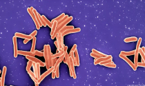 La bacteria Mycobacterium tuberculosis