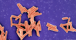 La bacteria Mycobacterium tuberculosis