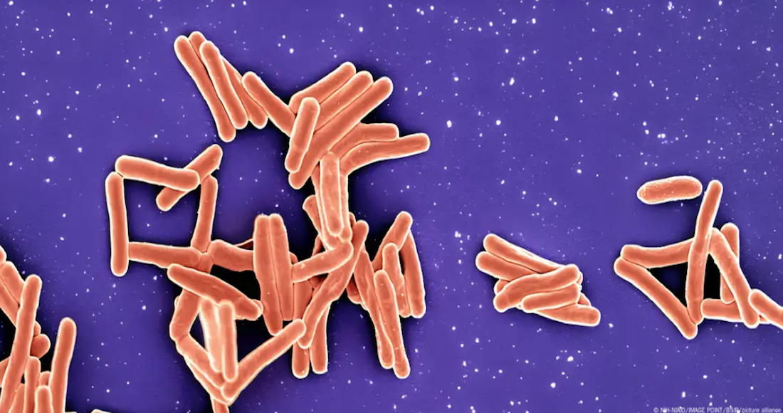 La bacteria Mycobacterium tuberculosis