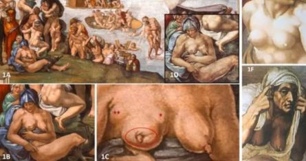 Una nueva investigación multidisciplinar propone que el fresco de Miguel Ángel "El diluvio" de la Capilla Sixtina retrata a una mujer joven que presenta signos compatibles con el cáncer de mama.